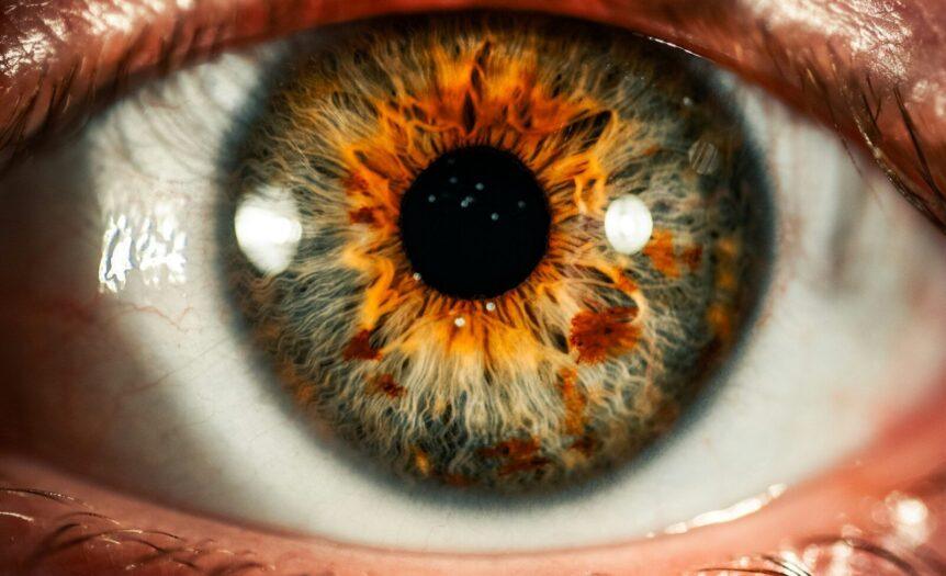 A close-up of a human eye with a grey and orange iris